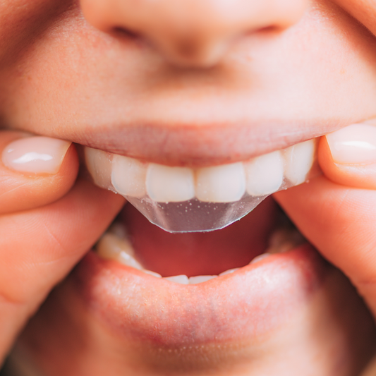 Bieliace pásiky Crest 3D Whitestrips Vivid – Profesionálne bielenie zubov doma