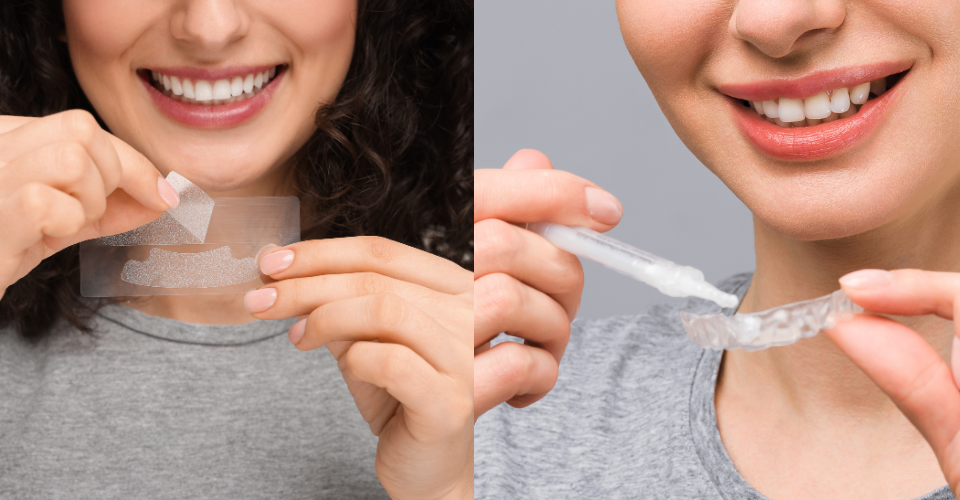 Pásiky vs. bieliace gély – ktorá metóda bielenia zubov je najlepšia?